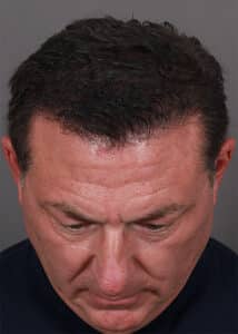 After Image: Male NeoGraft