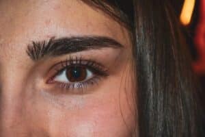 NeoGraft Eyebrow Restoration