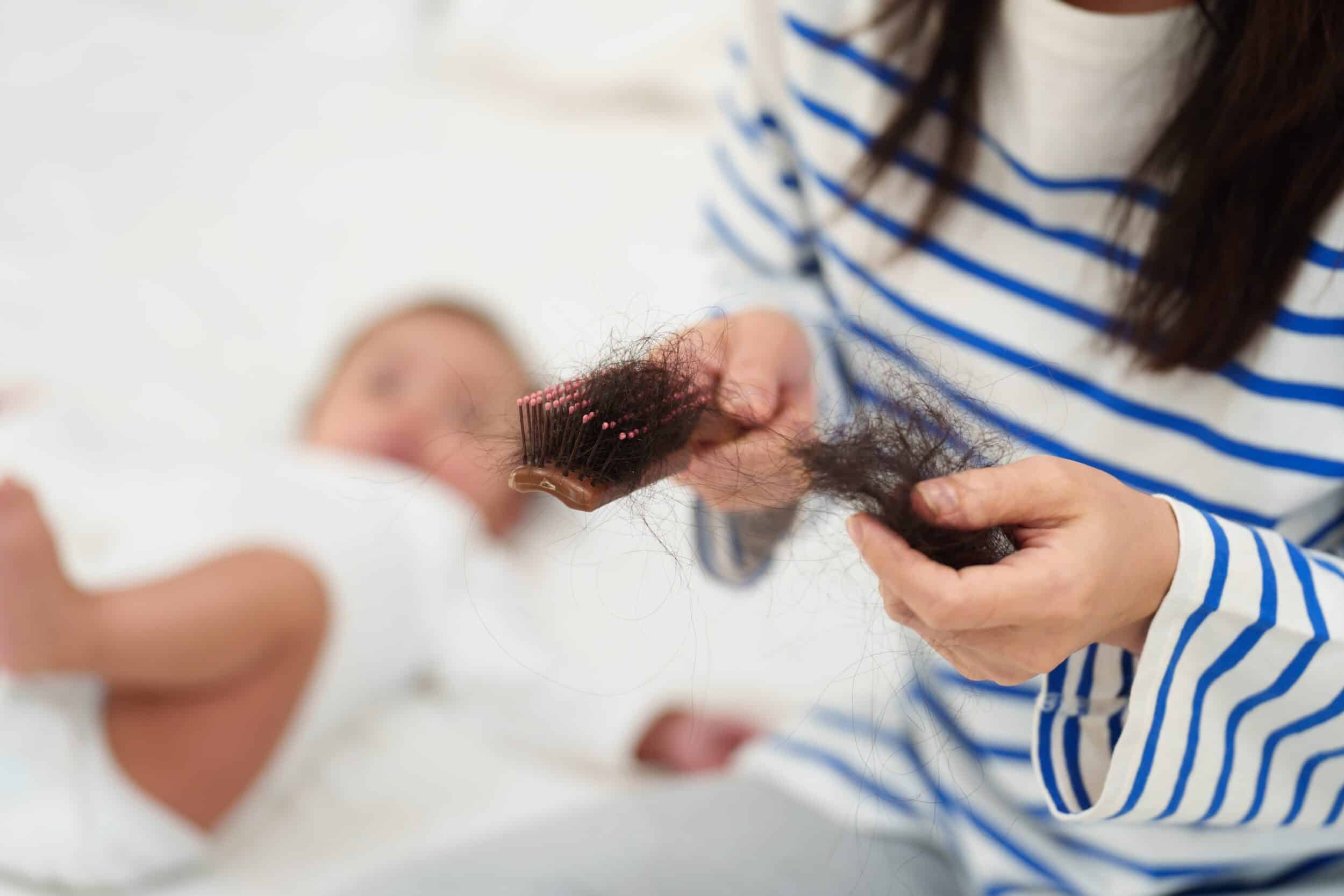 Postpartum Hair Loss Treatment in Washington D.C.