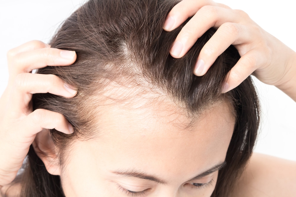 Woman experiencing postpartum hair shedding in Washington, DC